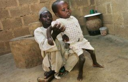La &quot;polio&quot; éradiquée en Afrique, quatre ans après les derniers cas au Nigeria - © Chris Hondros - Getty Images 
